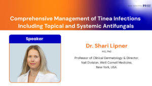 Comprehensive Management of Tinea Infections Including Topical and Systemic Antifungals